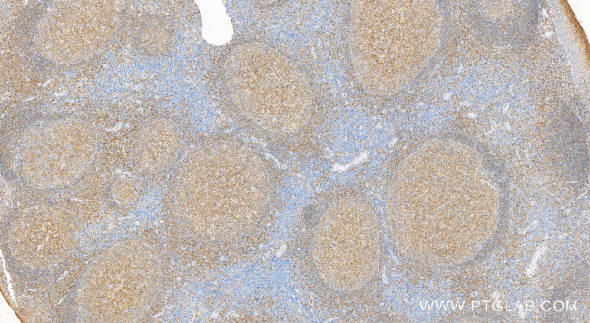 IL3RA/CD123 Antibody in Immunohistochemistry (Paraffin) (IHC (P))