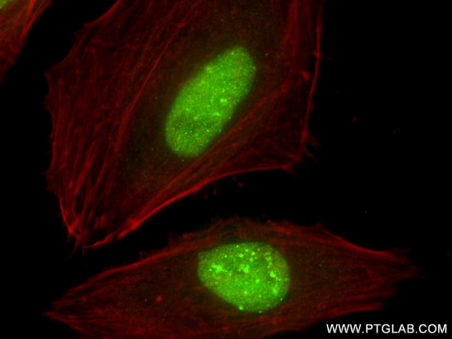 CBX1 Antibody in Immunocytochemistry (ICC/IF)