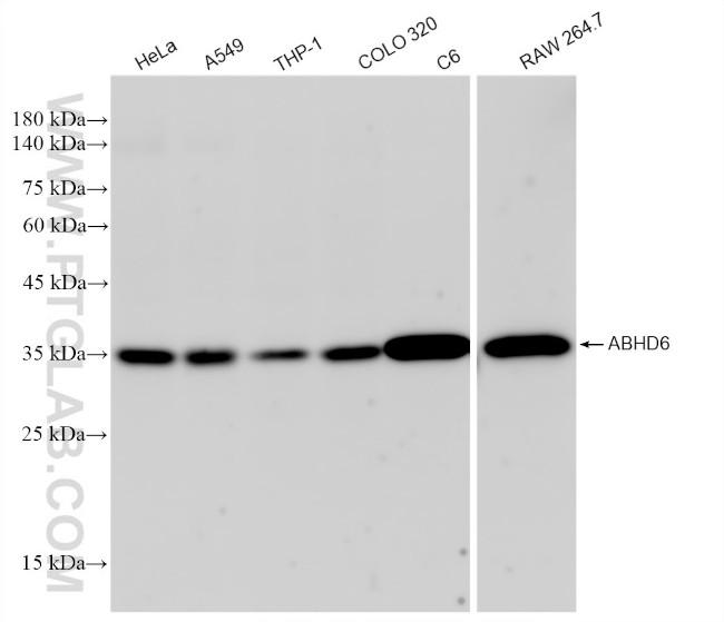 ABHD6 Antibody in Western Blot (WB)
