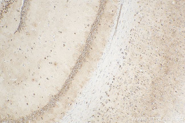 KCNJ15 Antibody in Immunohistochemistry (Paraffin) (IHC (P))