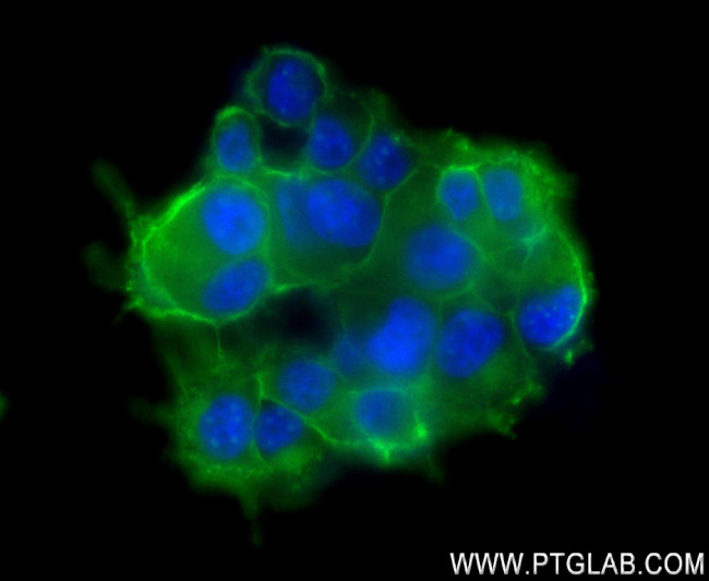 SNAP25 Antibody in Immunocytochemistry (ICC/IF)