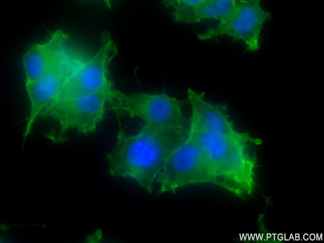 SNAP25 Antibody in Immunocytochemistry (ICC/IF)