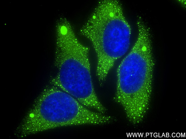 DGAT2 Antibody in Immunocytochemistry (ICC/IF)