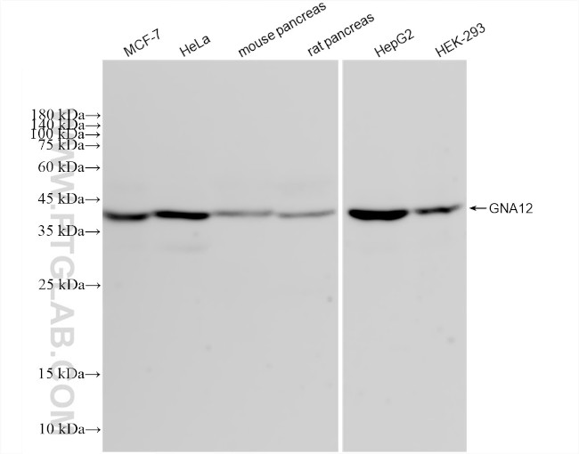 GNA12 Antibody in Western Blot (WB)