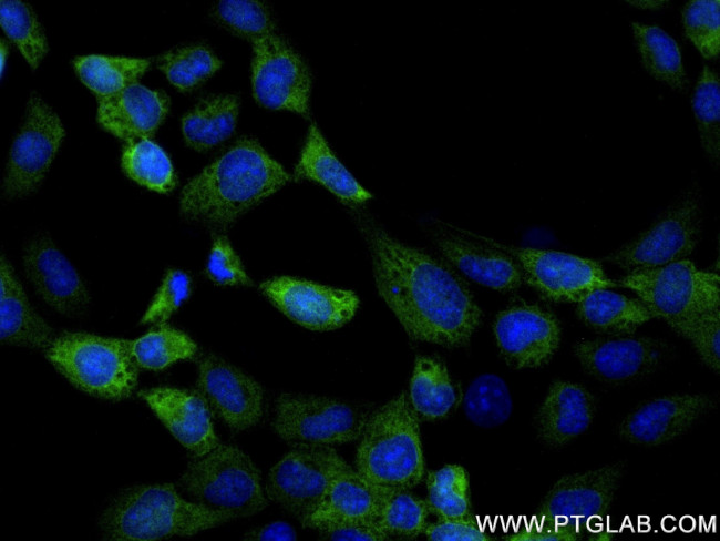 EFHD2 Antibody in Immunocytochemistry (ICC/IF)