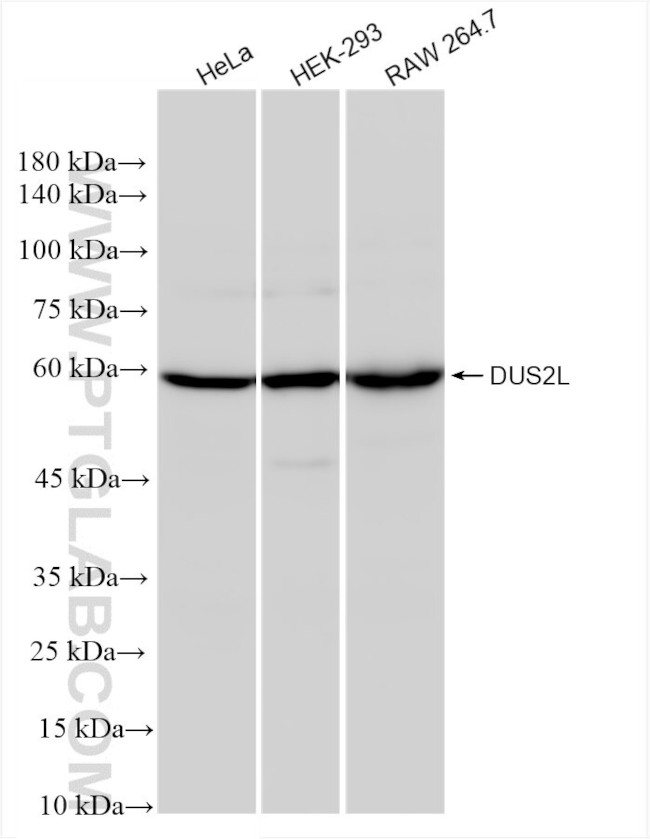 DUS2L Antibody in Western Blot (WB)