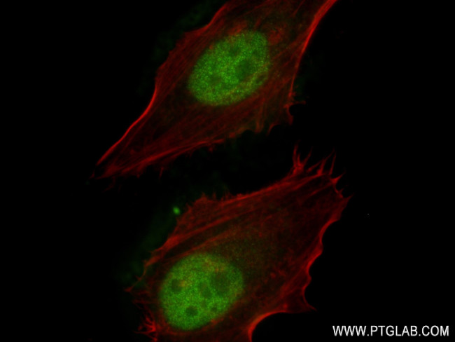 BUB3 Antibody in Immunocytochemistry (ICC/IF)