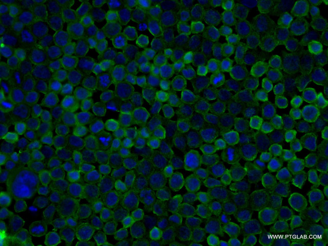 DOCK8 Antibody in Immunocytochemistry (ICC/IF)