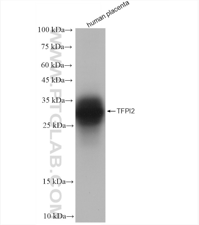 TFPI2 Antibody in Western Blot (WB)