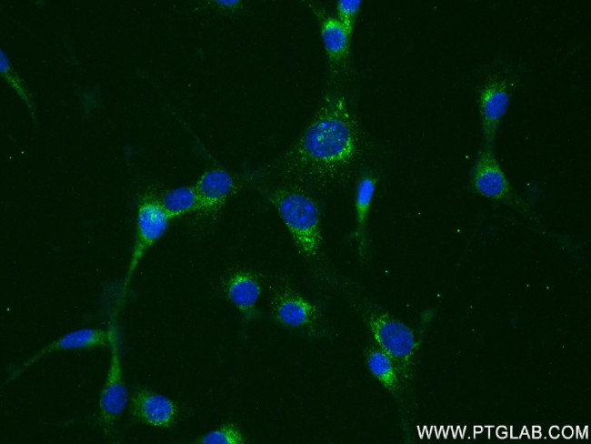 Shh Antibody in Immunocytochemistry (ICC/IF)
