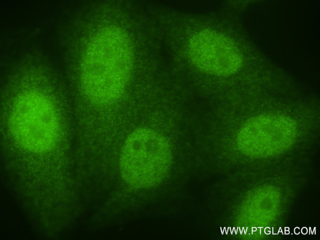 NUP85 Antibody in Immunocytochemistry (ICC/IF)