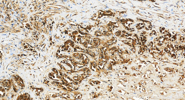 ECSIT Antibody in Immunohistochemistry (Paraffin) (IHC (P))