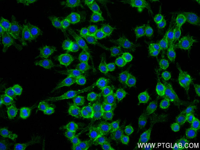 CD14 Antibody in Immunocytochemistry (ICC/IF)