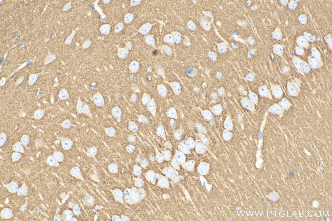 STX1B Antibody in Immunohistochemistry (Paraffin) (IHC (P))