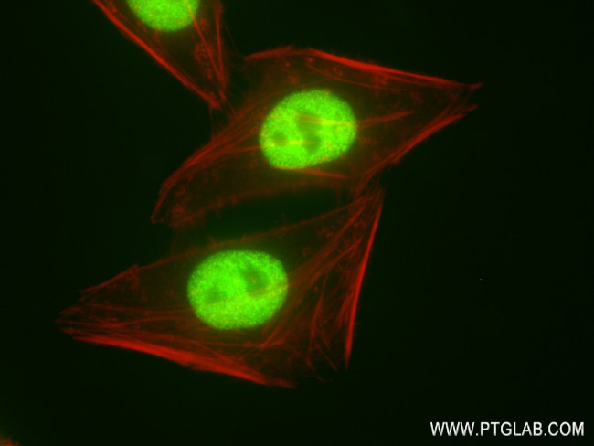 SMARCA4 Antibody in Immunocytochemistry (ICC/IF)