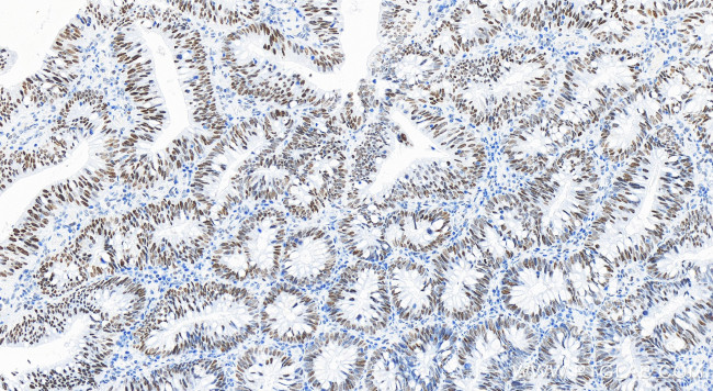 SMARCA4 Antibody in Immunohistochemistry (Paraffin) (IHC (P))