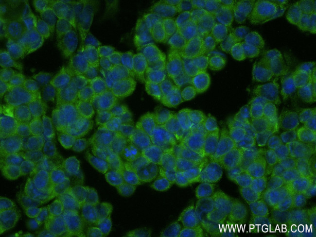 BRAP Antibody in Immunocytochemistry (ICC/IF)