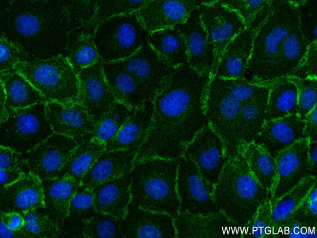 ADRB2 Antibody in Immunocytochemistry (ICC/IF)