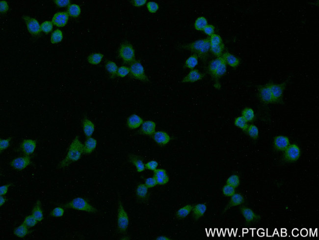 SAT1 Antibody in Immunocytochemistry (ICC/IF)