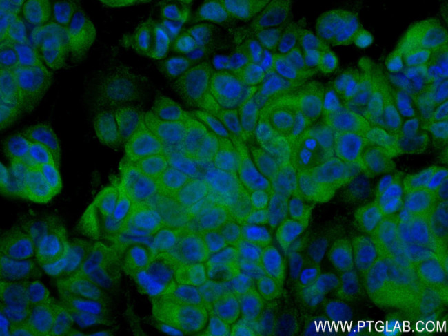 NRG1, isoform SMDF Antibody in Immunocytochemistry (ICC/IF)