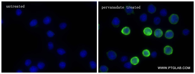 Phospho-SYK (Tyr323) Antibody in Immunocytochemistry (ICC/IF)