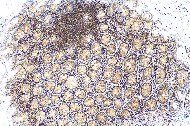 CRIP1 Antibody in Immunohistochemistry (Paraffin) (IHC (P))