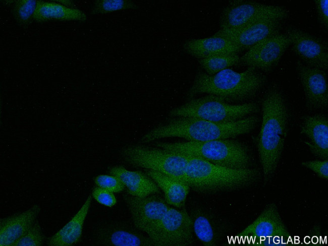 Osteopontin Antibody in Immunocytochemistry (ICC/IF)