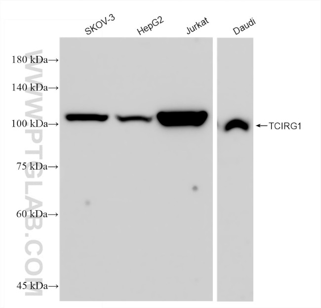 TCIRG1 Antibody in Western Blot (WB)