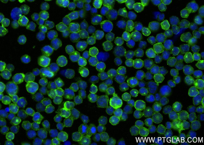 FGR Antibody in Immunocytochemistry (ICC/IF)