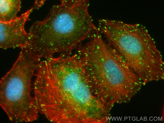 NEDD9 Antibody in Immunocytochemistry (ICC/IF)