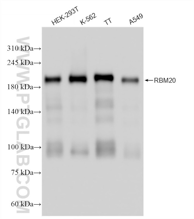 RBM20 Antibody in Western Blot (WB)