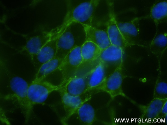 NCAM1/CD56 Antibody in Immunocytochemistry (ICC/IF)