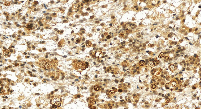 AHR Antibody in Immunohistochemistry (Paraffin) (IHC (P))