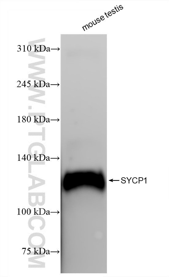 SYCP1 Antibody in Western Blot (WB)