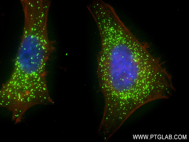 AGXT Antibody in Immunocytochemistry (ICC/IF)