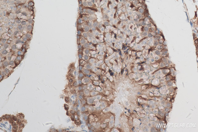 SIAH1 Antibody in Immunohistochemistry (Paraffin) (IHC (P))
