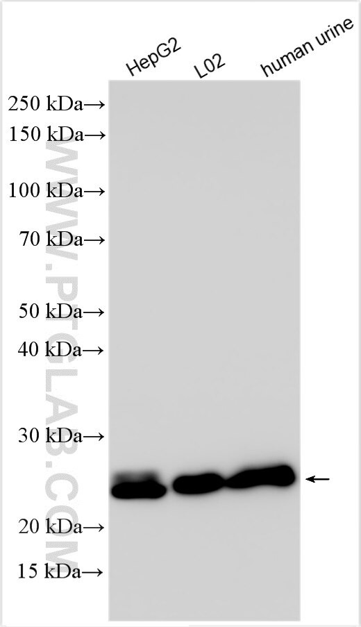 GGTLC1 Antibody in Western Blot (WB)