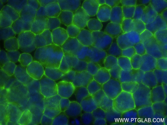 Fas/CD95 Antibody in Immunocytochemistry (ICC/IF)