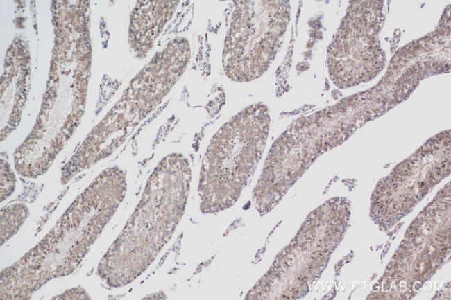 TSSK4 Antibody in Immunohistochemistry (Paraffin) (IHC (P))