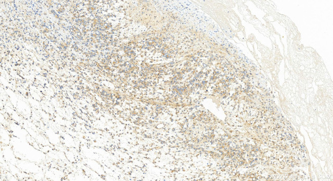FEZ2 Antibody in Immunohistochemistry (Paraffin) (IHC (P))