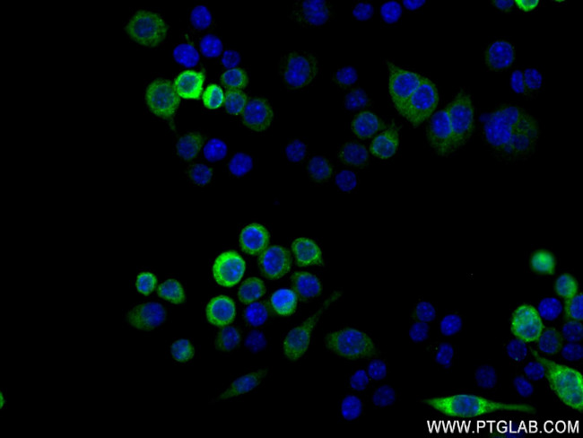 Osteopontin Antibody in Immunocytochemistry (ICC/IF)