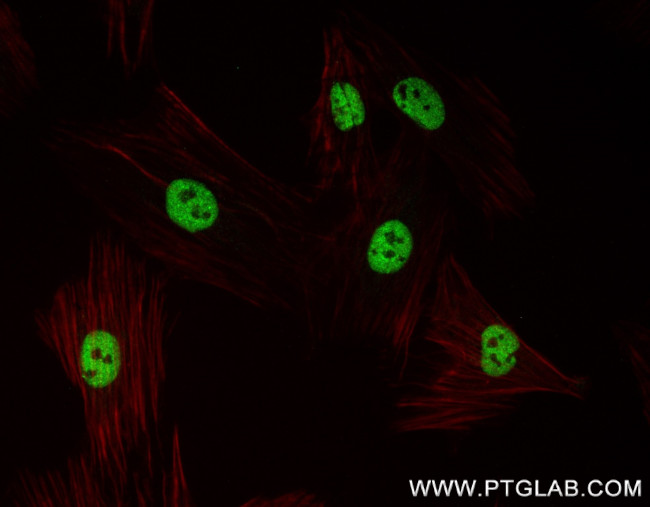 TBX20 Antibody in Immunocytochemistry (ICC/IF)