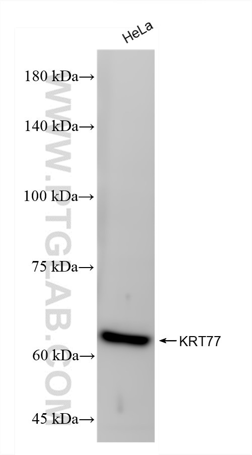 Keratin 77 Antibody in Western Blot (WB)