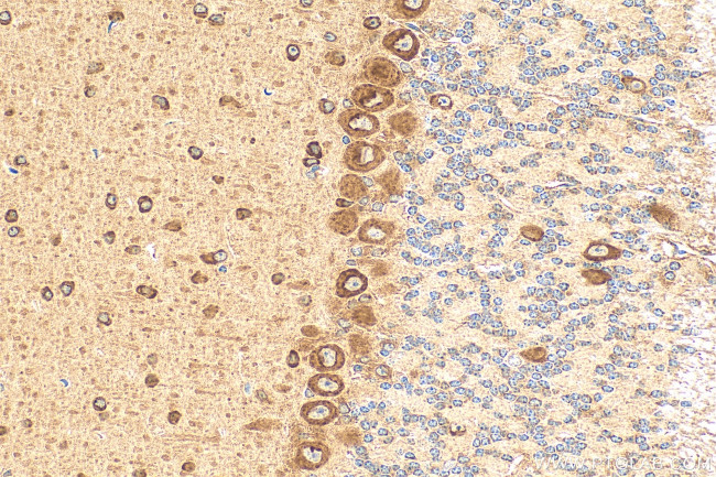 KIAA1715 Antibody in Immunohistochemistry (Paraffin) (IHC (P))