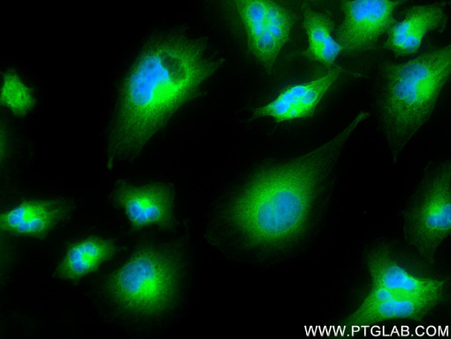 KIAA1715 Antibody in Immunocytochemistry (ICC/IF)