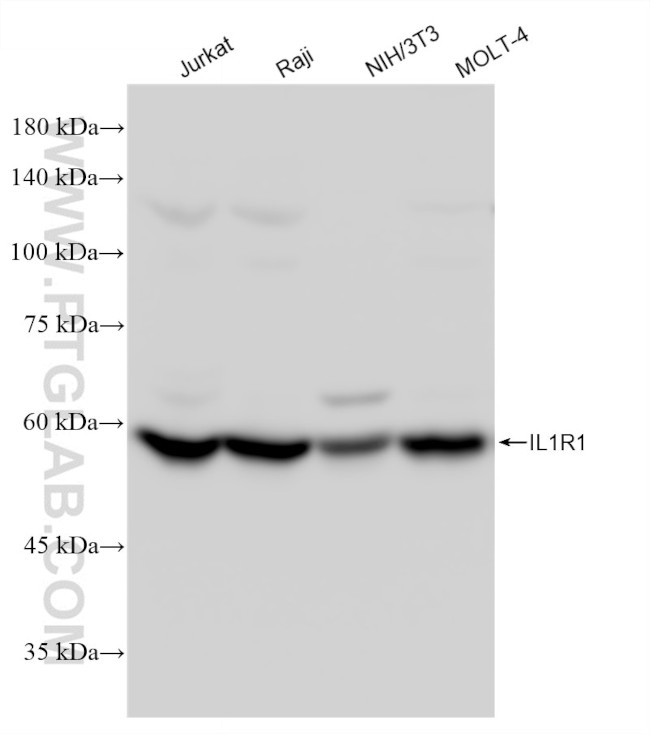 IL1R1 Antibody in Western Blot (WB)