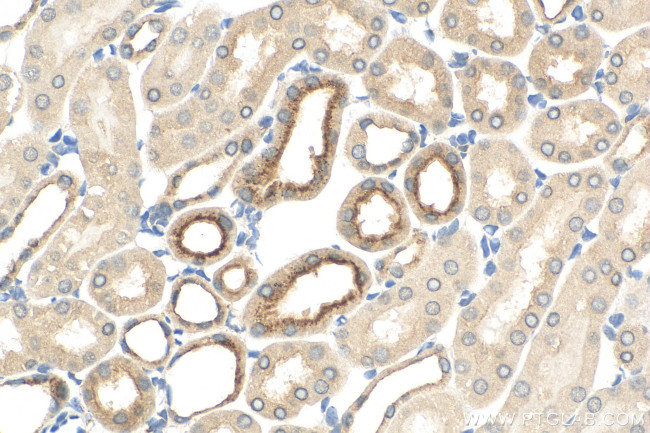 cystatin c Antibody in Immunohistochemistry (Paraffin) (IHC (P))