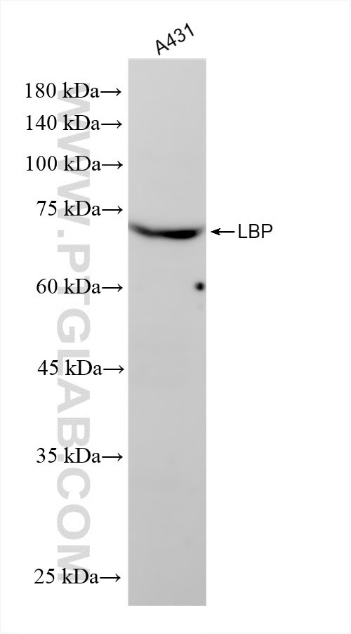LBP Antibody in Western Blot (WB)