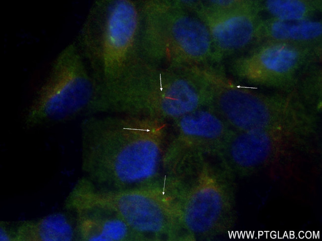 PLK2 Antibody in Immunocytochemistry (ICC/IF)