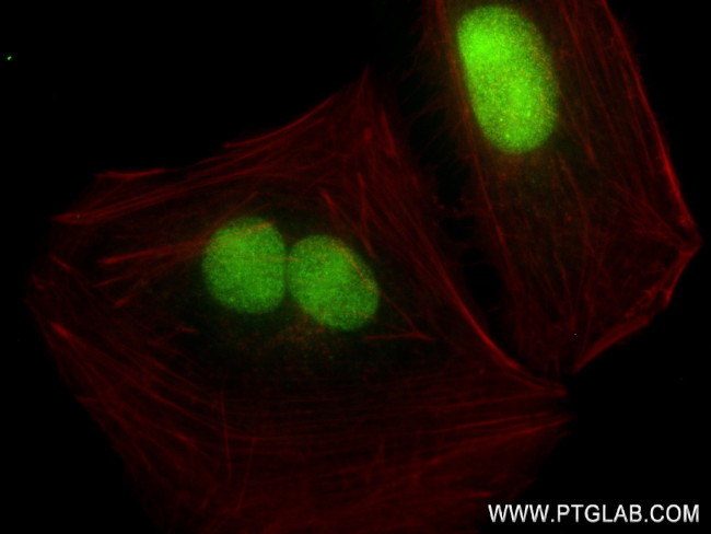 THOC5 Antibody in Immunocytochemistry (ICC/IF)